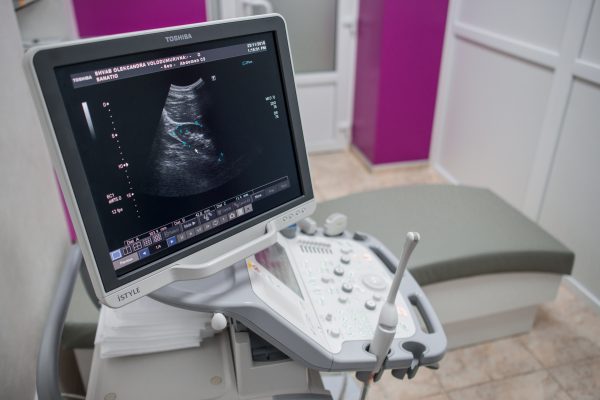 УЗД-діагностика в клініці SANATIO